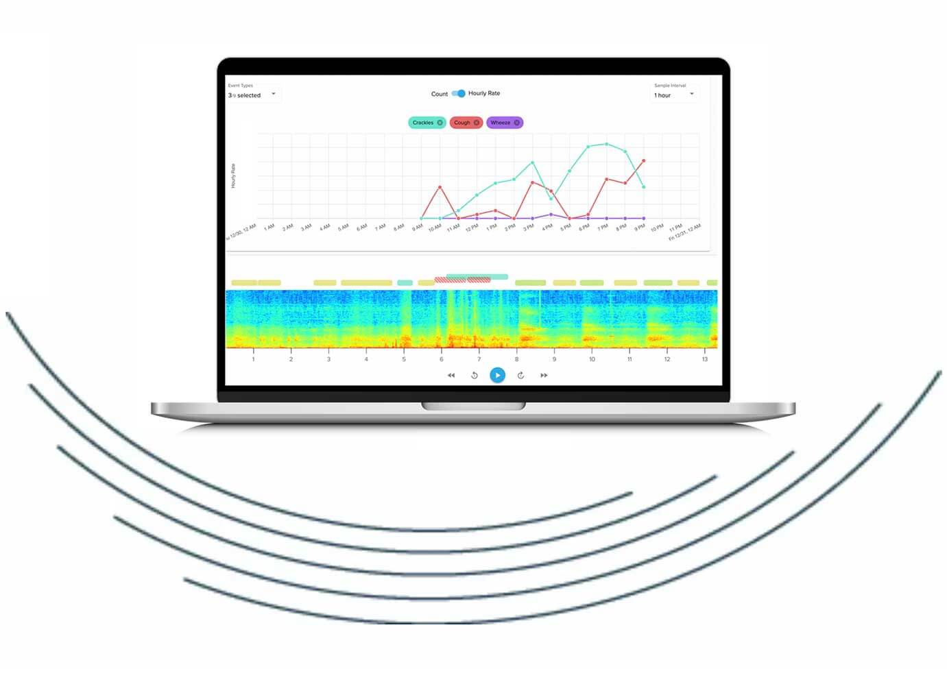 No intuitive feedback loop